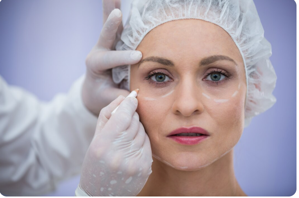 Straffung von Augenlidern